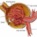 Nhonhi ở Vinh, Nghệ An - Tìm một nửa í