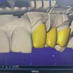 Phúc ở Cái Bè, Tiền Giang - Quéo